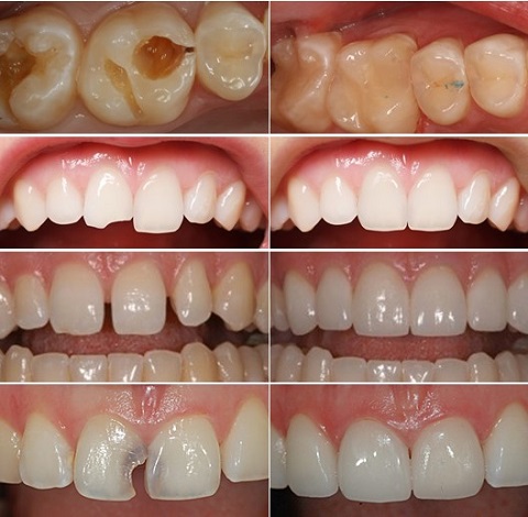 Bệnh Viện Tư Nhân Chuyên Khoa Răng Hàm Mặt Mỹ Thiện